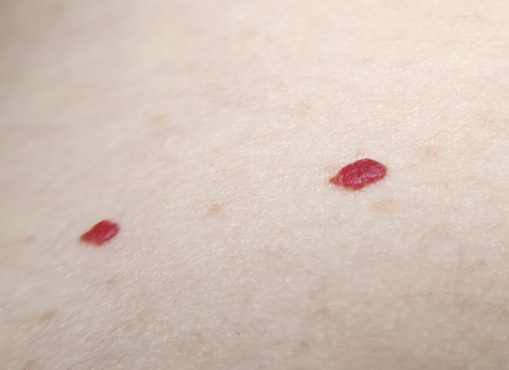 Oma Weet Raadt: Slakken In Huis? Zo Kom Je Eraf Met Ouderwetse Slimheid