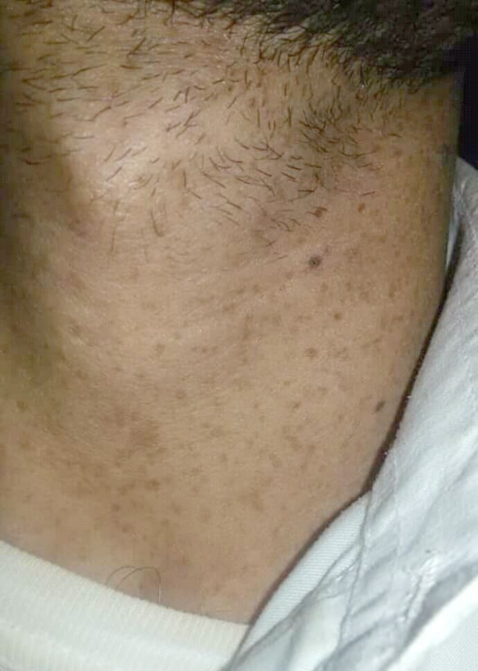 Scheerbultjes? Oma weet raad!